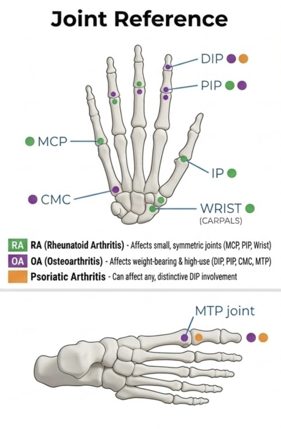 Hand and foot joint reference diagram showing MCP, PIP, DIP, IP, CMC, Wrist, and MTP joints color-coded for RA, OA, and Psoriatic Arthritis